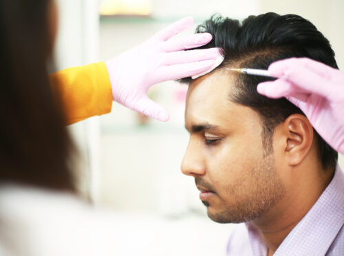 GFC Therapy - Treatment for Face & Reducing Hair Fall» SkinLab